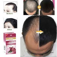 Wellice Anti Hair Loss Shampoo